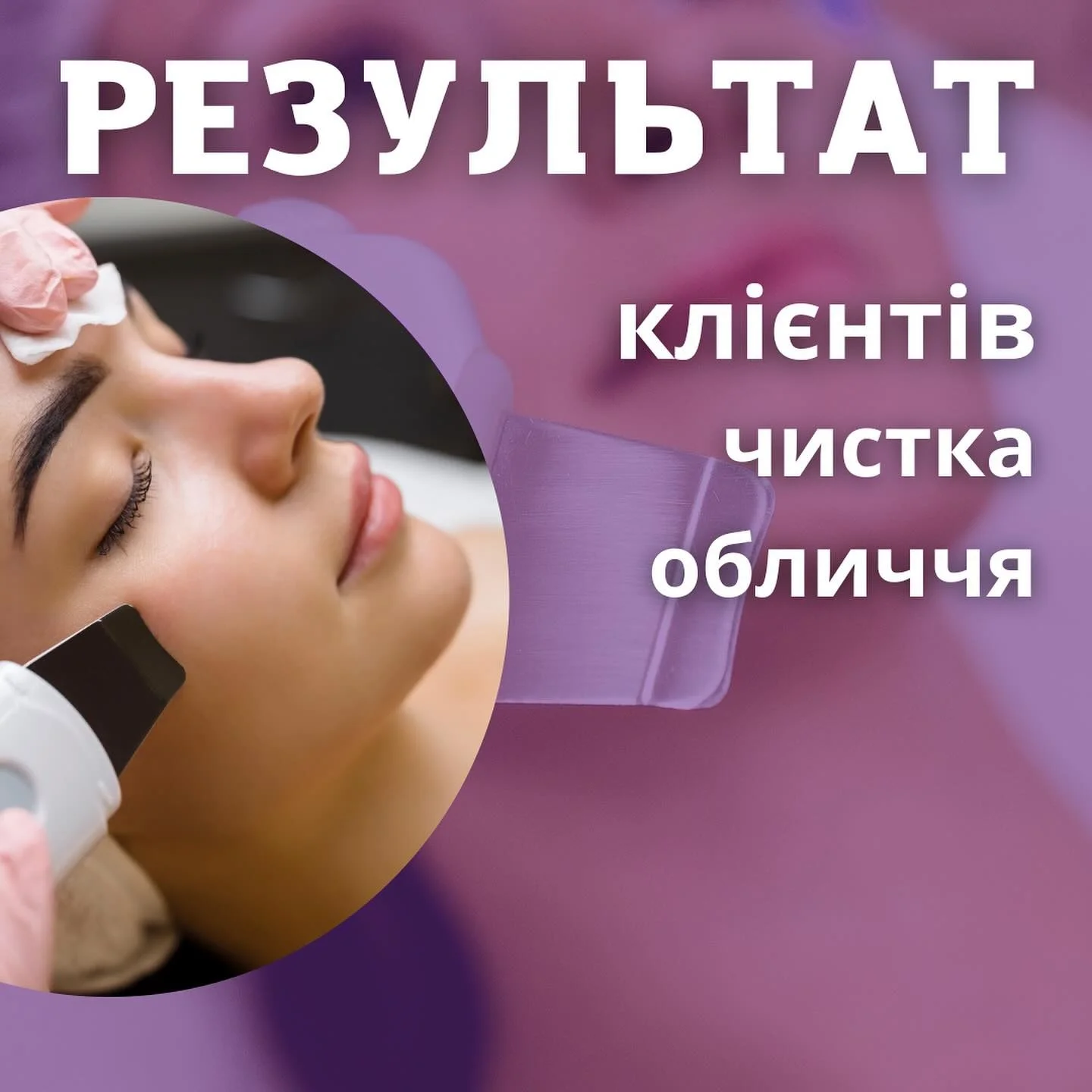 Чистка
