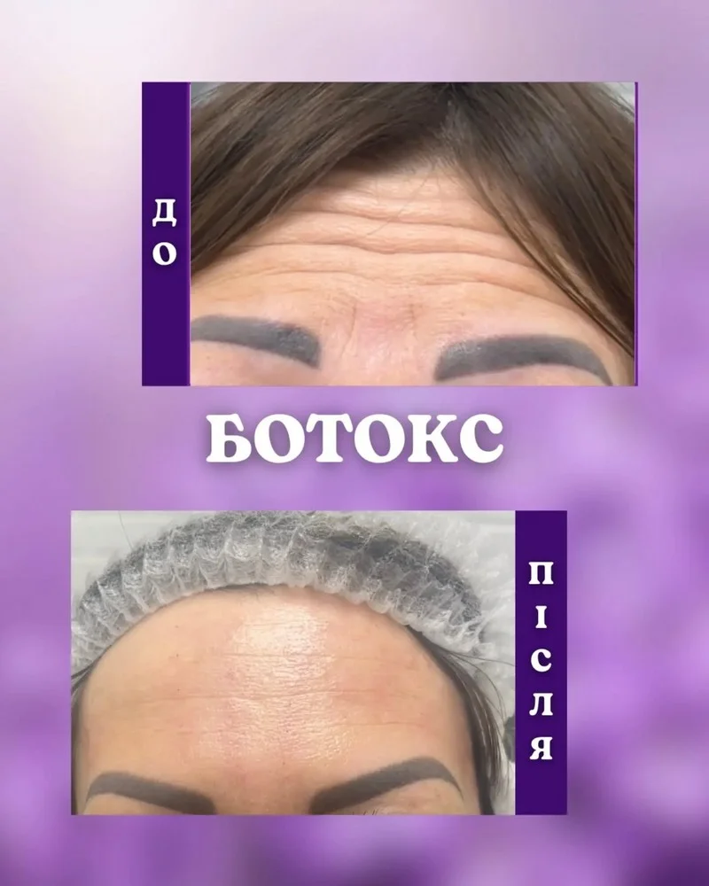 Результат до та після — Enjoy Beauty