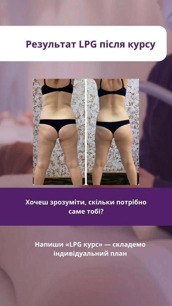 Результат до та після — Enjoy Beauty