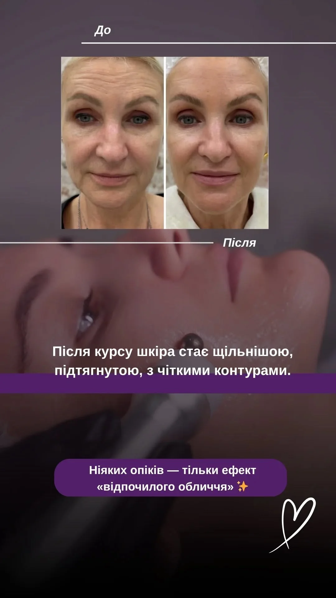 Результат