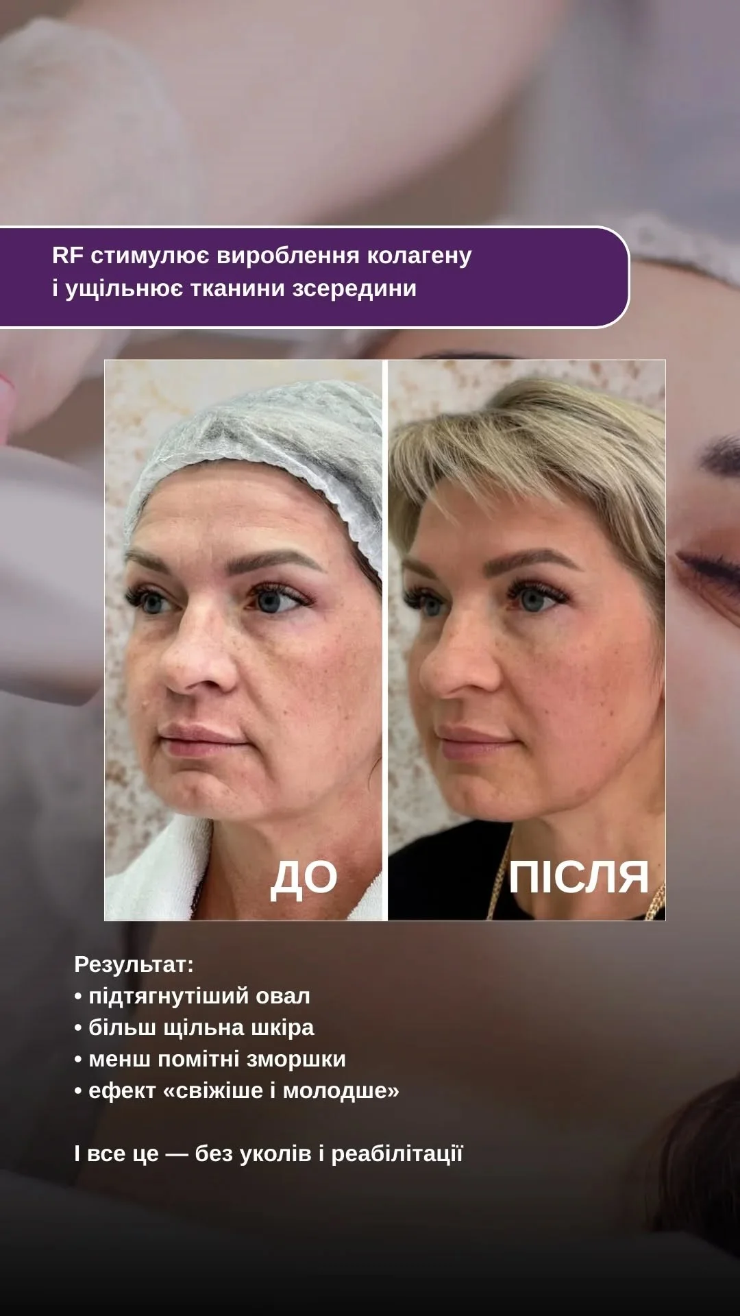Результат